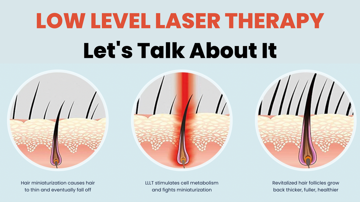 Low-Level Laser Therapy (LLLT ) for Hair Loss